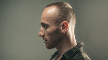 Hair Loss Modern Men